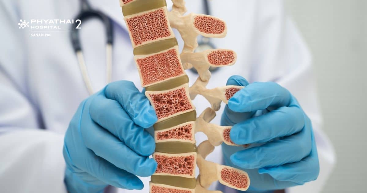 Osteoporosis Screening Program